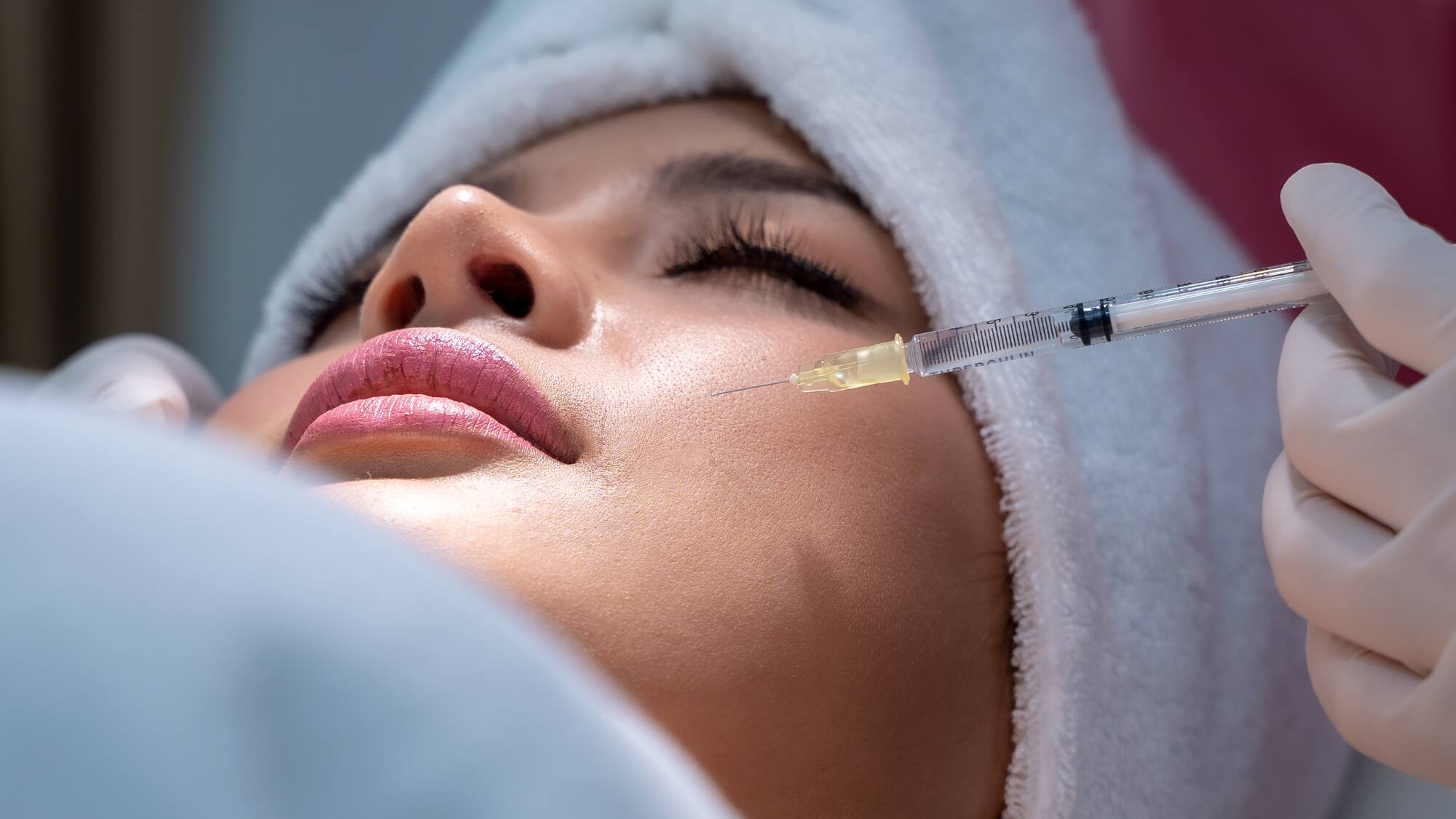 Lippen Aufspritzen Nürnberg: Der sanfte Weg zu vollen Lippen