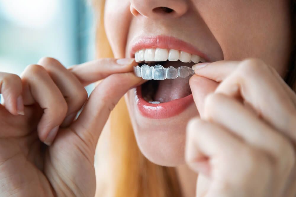 Zahnarzt Zürich bietet ganzheitliche Zahnbehandlungen, die sowohl Funktionalität als auch Ästhetik berücksichtigen